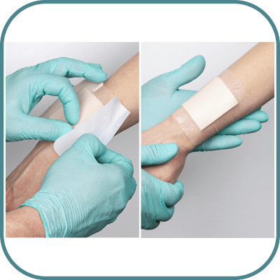 Remove the remaining release film(s) 