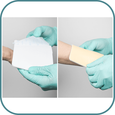 How to use evercare® Silicone Wound Contact Dressing - Secondary dressing