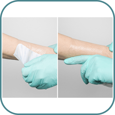 How to use evercare® Silicone Wound Contact Dressing - step 4